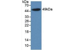 Western Blot; Sample: Recombinant a1AGP, Rat. (ORM1 抗体  (AA 19-186))