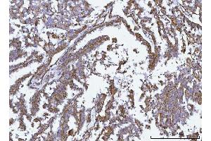 IHC analysis of GLUD1/2 using anti-GLUD1/2 antibody (ABIN7602000). (GLUD1 / GLUD2 (AA 54-553) 抗体)