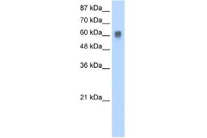 WB Suggested Anti-ZFP91 Antibody Titration:  0. (ZFP91 抗体  (N-Term))