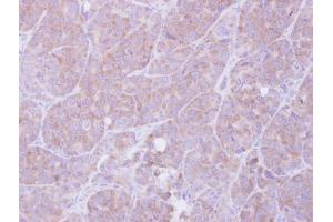 Immunohistochemistry (IHC) image for anti-Macrophage Migration Inhibitory Factor (Glycosylation-Inhibiting Factor) (MIF) antibody (ABIN2854957)