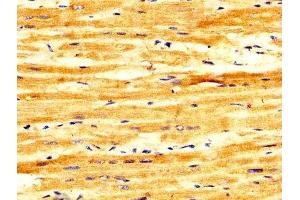 IHC image of ABIN7152598 diluted at 1:300 and staining in paraffin-embedded human heart tissue performed on a Leica BondTM system. (FASTKD2 抗体  (AA 117-203))