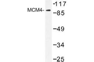 Image no. 1 for anti-Minichromosome Maintenance Deficient 4 (MCM4) antibody (ABIN317884) (MCM4 抗体)