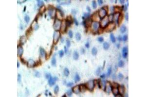 Immunohistochemistry (IHC) image for anti-Protein tyrosine Phosphatase, Receptor Type, C (PTPRC) (AA 644-900) antibody (ABIN1860366)