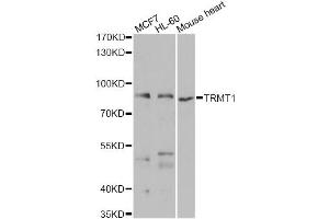 Western blot analysis of extracts of various cell lines, using TRMT1 antibody. (TRMT1 抗体)