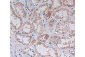 Used in DAB staining on fromalin fixed paraffin- embedded Kidney tissue (ILK 抗体  (AA 183-452))