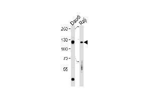 Rb Antibody  (ABIN1881730 and ABIN2840685) western blot analysis in Daudi,Raji cell line lysates (35 μg/lane). (Retinoblastoma 1 抗体  (AA 586-615))