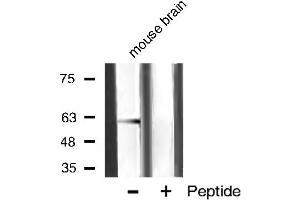 Western blot analysis of akt2 phosphorylation expression in mouse brain tissue lysates,The lane on the right is treated with the antigen-specific peptide. (AKT2 抗体  (pSer474))