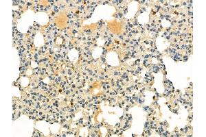 ABIN6255286 and ABIN6267647 at 1/100 staining Rat lung tissue by IHC-P. (IRF3 抗体  (pSer386))