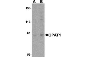 Western Blotting (WB) image for anti-Glycerol-3-Phosphate Acyltransferase, Mitochondrial (GPAM) (C-Term) antibody (ABIN1030417) (GPAM 抗体  (C-Term))