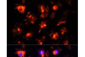 Immunofluorescence analysis of HUVEC cells using CD31 Polyclonal Antibody at dilution of 1:100. (CD31 抗体)