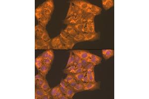 Immunofluorescence analysis of U2OS cells using PFKL antibody (ABIN7269308) at dilution of 1:100. (PFKL 抗体  (AA 700-780))