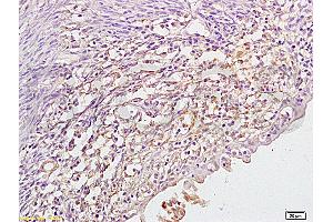 Immunohistochemistry (IHC) image for anti-Cytochrome P450, Family 17, Subfamily A, Polypeptide 1 (CYP17A1) (AA 24-65) antibody (ABIN720071)