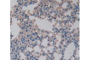 IHC-P analysis of Mouse Tissue, with DAB staining. (FABP5 抗体  (AA 2-135))