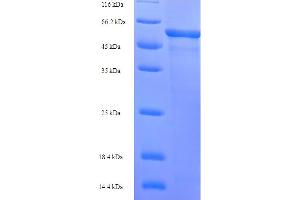 SDS-PAGE (SDS) image for L-2-Hydroxyglutarate Dehydrogenase (L2HGDH) (AA 52-463) protein (His-SUMO Tag) (ABIN5711783)