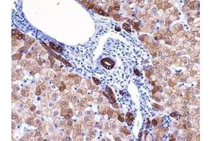 Immunohistochemistry (IHC) image for anti-Keratin 18 (KRT18) (C-Term) antibody (ABIN870569) (Cytokeratin 18 抗体  (C-Term))
