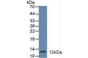 Detection of DEFa1 in Human Liver Tissue using Polyclonal Antibody to Defensin Alpha 1, Neutrophil (DEFa1) (alpha Defensin 1 抗体  (AA 20-94))