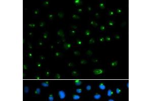Immunofluorescence analysis of MCF-7 cells using PSAP Polyclonal Antibody (Prosaposin 抗体)