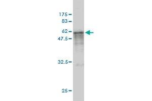 Western Blot detection against Immunogen (67. (CASQ2 抗体  (AA 20-399))