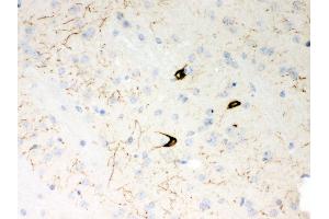 Anti- Neuropeptide Y Picoband antibody,IHC(P) IHC(P): Mouse Brain Tissue (NPY 抗体  (Middle Region))