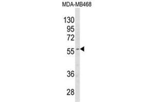 Western blot analysis of CYP4B1 Antibody (Center) in MDA-MB468 cell line lysates (35ug/lane).
