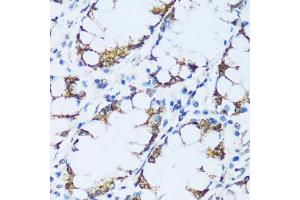 Immunohistochemistry (IHC) image for anti-Complement Component 1, Q Subcomponent, C Chain (C1QC) (AA 50-150) antibody (ABIN7266475)