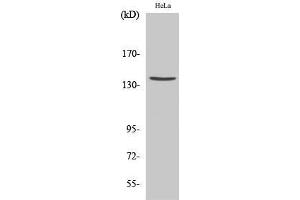 Western Blot (WB) analysis of specific cells using Cleaved-Spectrin alpha II (D1185) Polyclonal Antibody. (SPTAN1 抗体  (Asp1185, cleaved))
