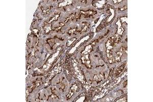 Immunohistochemical staining of human kidney with ITPKA polyclonal antibody  shows strong membranous and cytoplasmic positivity in tubular cells at 1:200-1:500 dilution. (ITPKA 抗体)