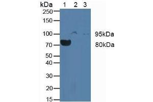 Western blot analysis of (1) Rat Blood Cells, (2) Human JAR Cells and (3) Human Placenta Tissue. (CSF3R 抗体  (AA 26-138))