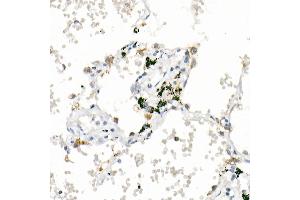 Immunohistochemistry of paraffin-embedded human lung using  Rabbit mAb (ABIN7265424) at dilution of 1:1000 (40x lens). (ACSL4 抗体)
