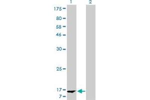 Western Blot analysis of FABP1 expression in transfected 293T cell line by FABP1 monoclonal antibody (M02A), clone 5F7. (FABP1 抗体  (AA 1-127))