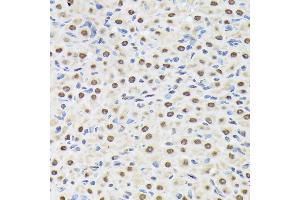 Immunohistochemistry of paraffin-embedded rat ovary using Matrin 3 Rabbit mAb (ABIN7268414) at dilution of 1:100 (40x lens).