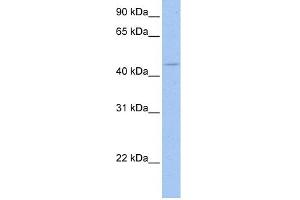 WB Suggested Anti-SOX8 Antibody Titration:  0. (SOX8 抗体  (C-Term))