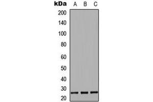 Western blot analysis of IL-27B expression in HeLa (A), Raw264. (EBI3 抗体  (Center))