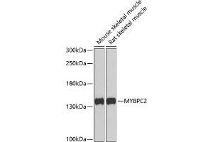 Western blot analysis of extracts of various cell lines, using MYBPC2 antibody (ABIN6129608, ABIN6144218, ABIN6144220 and ABIN6222676) at 1:1000 dilution.