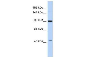GRIP1 antibody used at 2. (GRIP1 抗体  (C-Term))