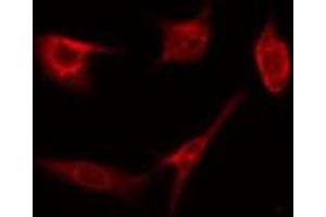 Immunofluorescence (fixed cells) (IF/ICC) image for anti-Cytochrome P450, Family 4, Subfamily Z, Polypeptide 1 (CYP4Z1) antibody (ABIN6258081)