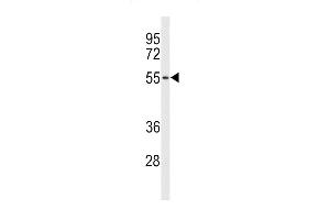 Western blot analysis of ACCN1 Antibody (Center) (ABIN653161 and ABIN2842729) in NCI- cell line lysates (35 μg/lane). (ACCN1 抗体  (AA 120-148))