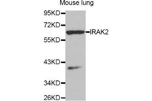 Western Blotting (WB) image for anti-Interleukin-1 Receptor-Associated Kinase 2 (IRAK2) antibody (ABIN1873258) (IRAK2 抗体)