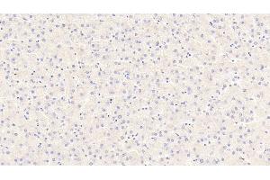 Detection of PCK2 in Human Liver Tissue using Polyclonal Antibody to Phosphoenolpyruvate Carboxykinase 2, Mitochondrial (PCK2) (PEPCK 抗体  (AA 33-198))