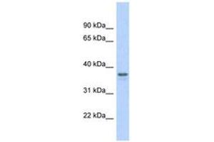 Image no. 1 for anti-Glyceraldehyde-3-Phosphate Dehydrogenase (GAPDH) (AA 107-156) antibody (ABIN6742094) (GAPDH 抗体  (AA 107-156))