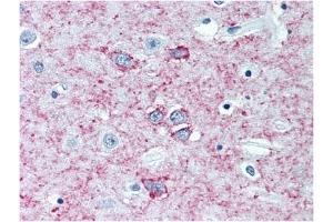 Immunohistochemistry (IHC) image for anti-Adenosine A2a Receptor (ADORA2A) antibody (ABIN487435) (Adenosine A2a Receptor 抗体)