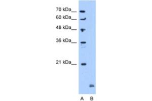Western Blotting (WB) image for anti-Crystallin, alpha B (CRYAB) antibody (ABIN2463152) (CRYAB 抗体)