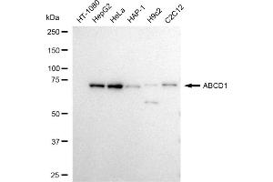 Western blotting analysis using ABCD1 antibody (ABIN7797686). (Recombinant ABCD1 抗体)
