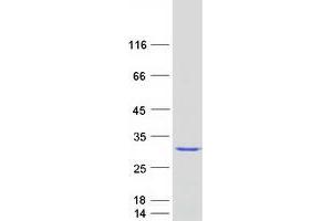 Validation with Western Blot (SSX4 Protein (Transcript Variant 1) (Myc-DYKDDDDK Tag))