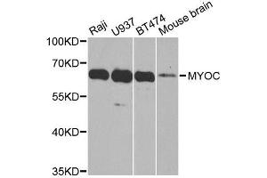 Western blot analysis of extracts of various cell lines, using MYOC antibody. (MYOC 抗体  (AA 245-504))