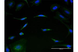 Immunofluorescence of monoclonal antibody to MRPL1 on HeLa cell. (MRPL1 抗体  (AA 1-303))