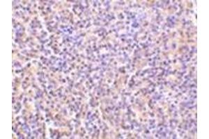 Immunohistochemistry of TCCR in human spleen tissue with this product at 5 μg/ml. (IL27 Receptor alpha 抗体  (C-Term))