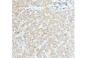 IHC analysis of NOB1 using anti-NOB1 antibody (ABIN7599344). (NOB1 抗体  (AA 1-389))