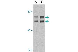 Western blot analysis of JPH2 in mouse brain tissue lysate with JPH2 polyclonal antibody  at (A) 1 and (B) 2 ug/mL . (Junctophilin 2 抗体  (C-Term))