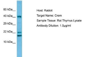WB Suggested Anti-Crem Antibody   Titration: 1. (CREM 抗体  (C-Term))